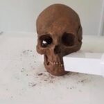 Vikings 1,000 Years Ago Had Surprisingly Advanced Dental Care